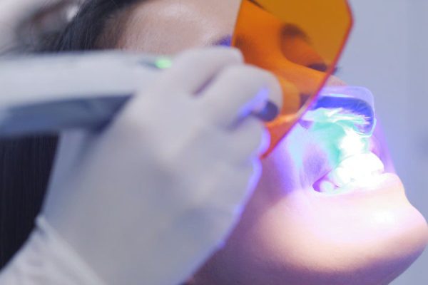 Clareamento Dental