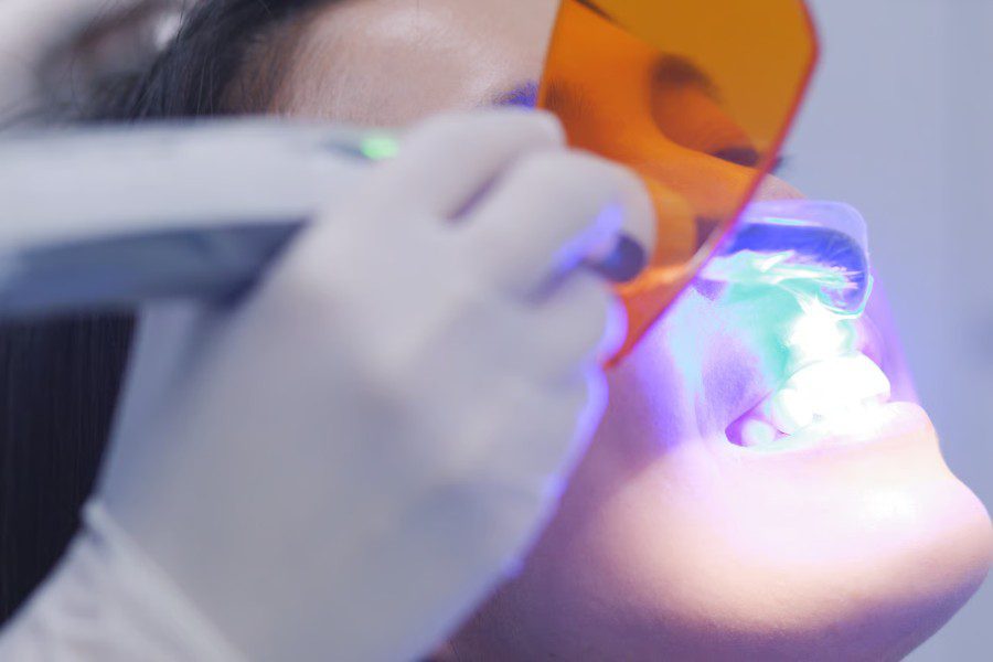 Clareamento Dental